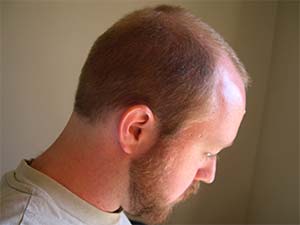 DaysLikeThese/A Daily Photo Project:August 8th, 2003-Today